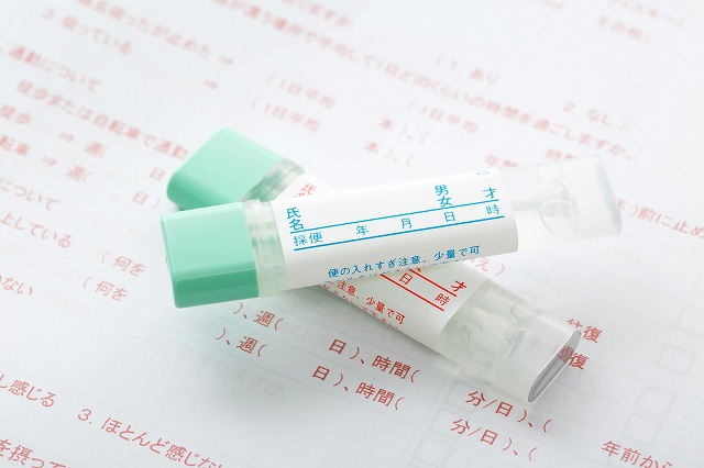 便潜血検査とは
